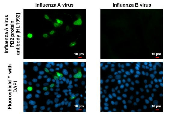 Influenza A PB2 Antibody in Immunocytochemistry (ICC/IF)