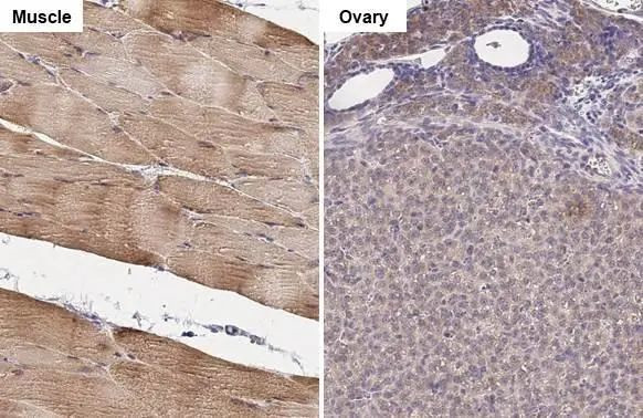 PFKM Antibody in Immunohistochemistry (Paraffin) (IHC (P))