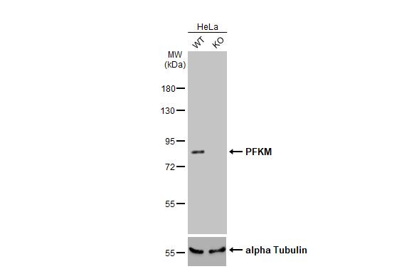 PFKM Antibody in Western Blot (WB)