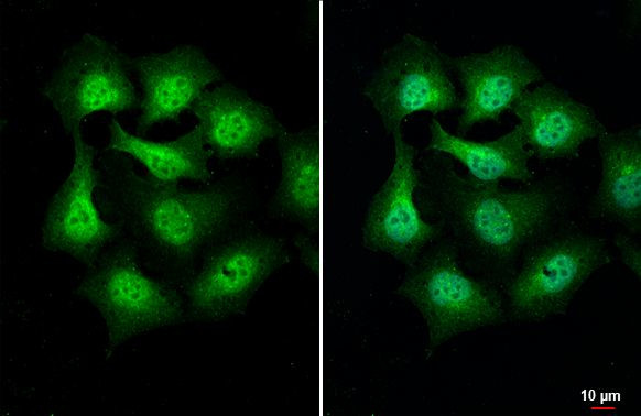 PIP5K1A Antibody in Immunocytochemistry (ICC/IF)