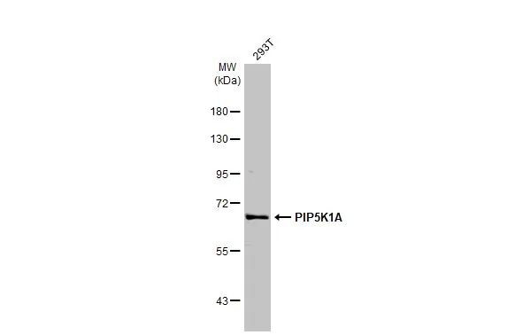 PIP5K1A Antibody in Western Blot (WB)