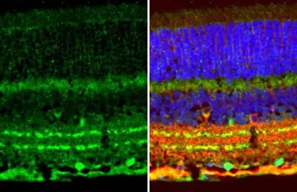 ChAT Antibody in Immunohistochemistry (Paraffin) (IHC (P))