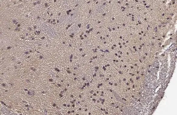 ChAT Antibody in Immunohistochemistry (Paraffin) (IHC (P))