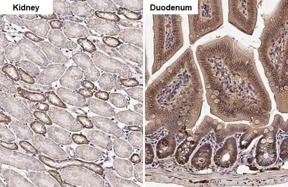 HPRT1 Antibody in Immunohistochemistry (Paraffin) (IHC (P))