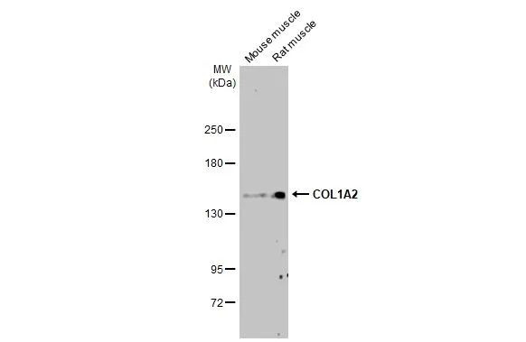 COL1A2 Antibody in Western Blot (WB)