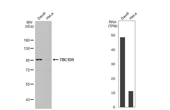 TBC1D5 Antibody in Western Blot (WB)