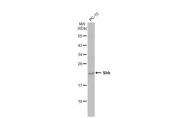 SHH Antibody in Western Blot (WB)