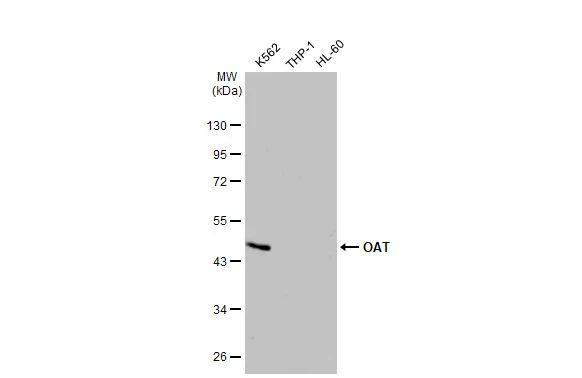 OAT Antibody in Western Blot (WB)