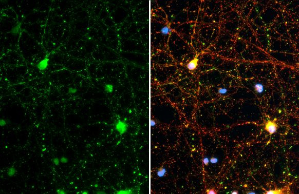 Synapsin II Antibody in Immunocytochemistry (ICC/IF)