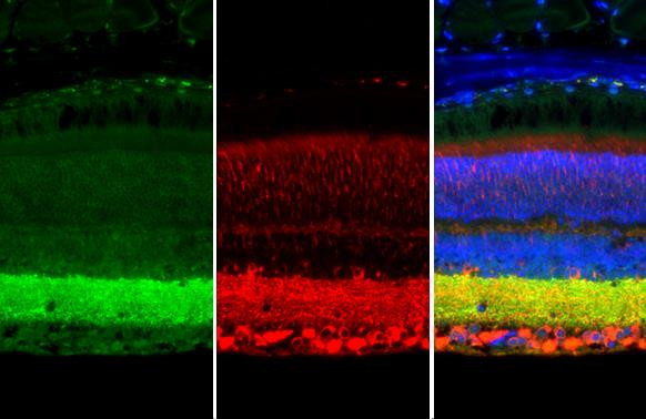 Synapsin II Antibody in Immunohistochemistry (Paraffin) (IHC (P))