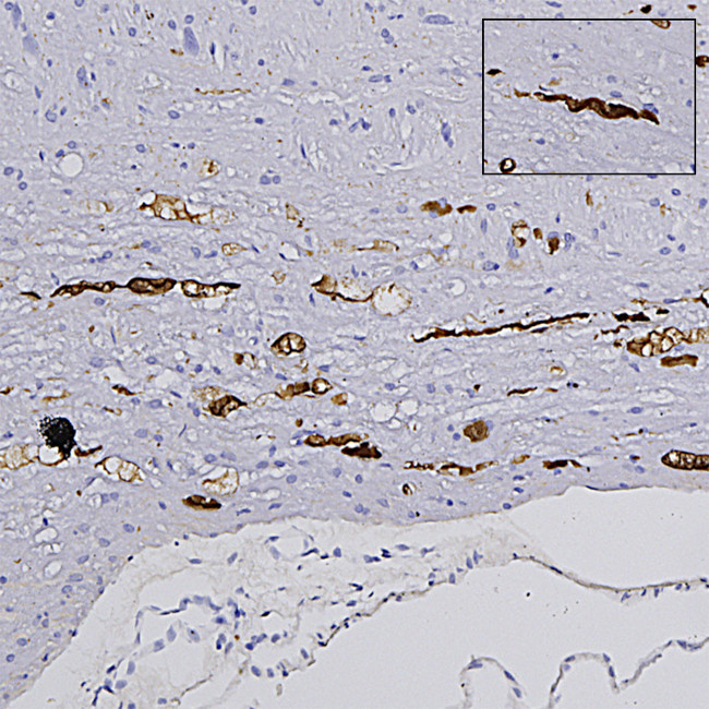 NEFL Antibody in Immunohistochemistry (Paraffin) (IHC (P))