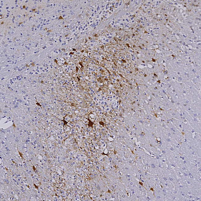 mCherry Antibody in Immunohistochemistry (Paraffin) (IHC (P))