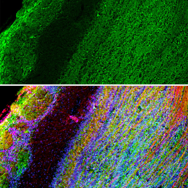 GAP43 Antibody in Immunocytochemistry (ICC/IF)