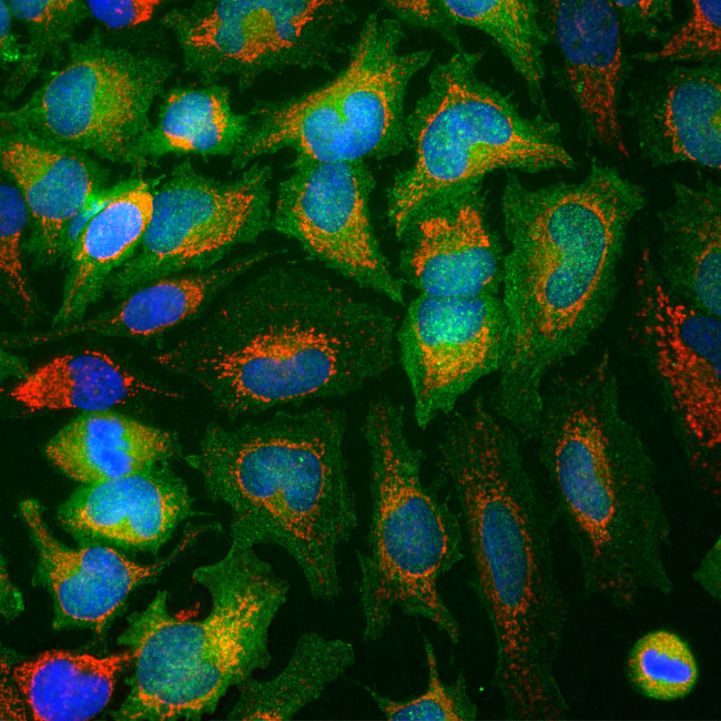 ENO1 Antibody in Immunocytochemistry (ICC/IF)