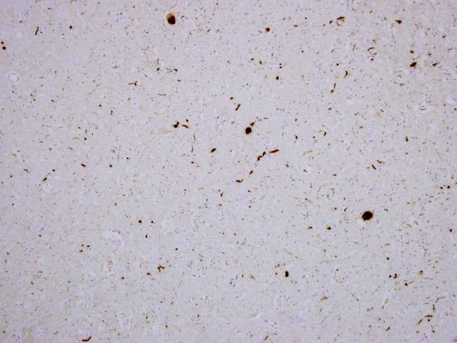 alpha Synuclein Antibody in Immunohistochemistry (PFA fixed) (IHC (PFA))