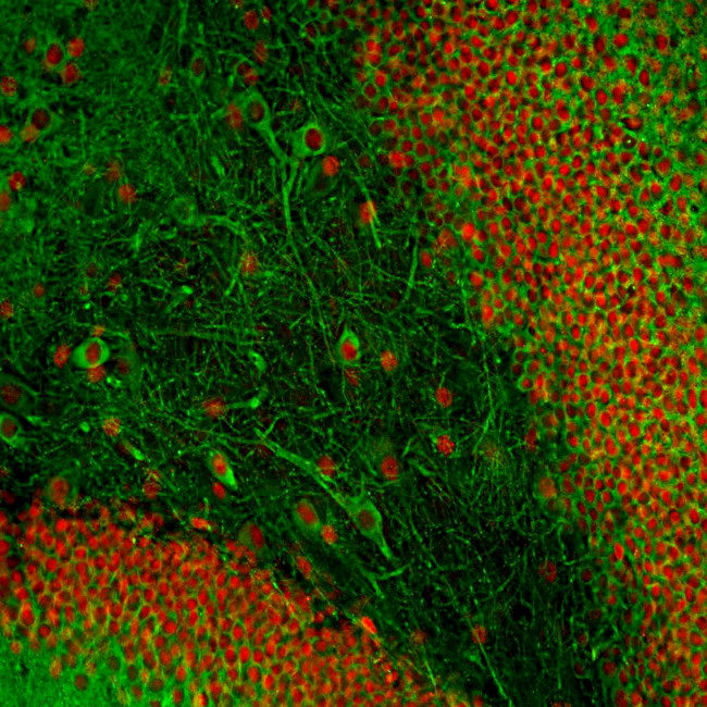 MAP2 Antibody in Immunohistochemistry (PFA fixed) (IHC (PFA))