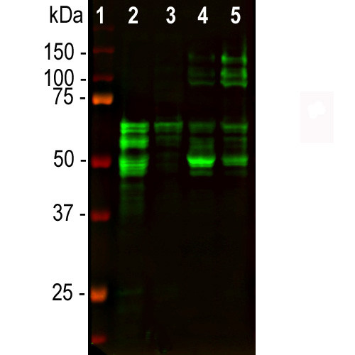 Tau Antibody in Western Blot (WB)