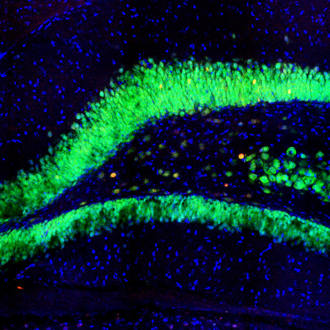 c-Fos Antibody in Immunohistochemistry (IHC)