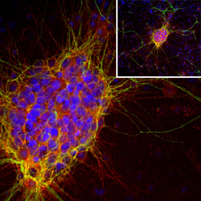 Doublecortin Antibody in Immunocytochemistry (ICC/IF)