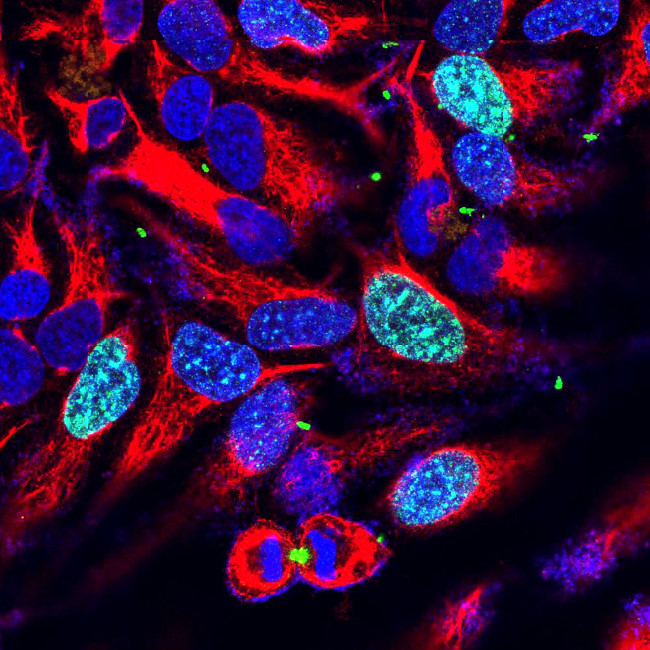 Aurora B Antibody in Immunocytochemistry (ICC/IF)