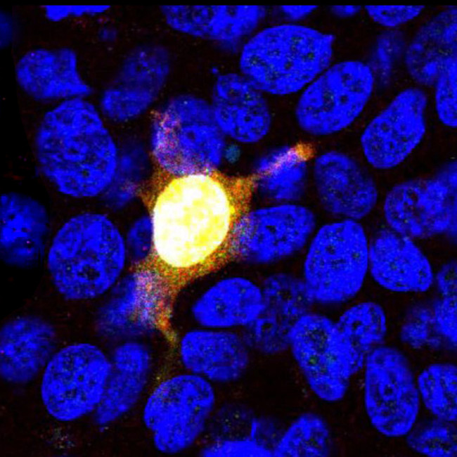 Cas9 Antibody in Immunocytochemistry (ICC/IF)