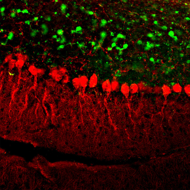 Calretinin Antibody in Immunohistochemistry (PFA fixed) (IHC (PFA))