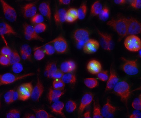 Aurora A/B Antibody in Immunocytochemistry (ICC/IF)