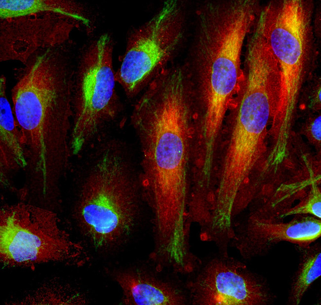 Annexin A6 Antibody in Immunocytochemistry (ICC/IF)