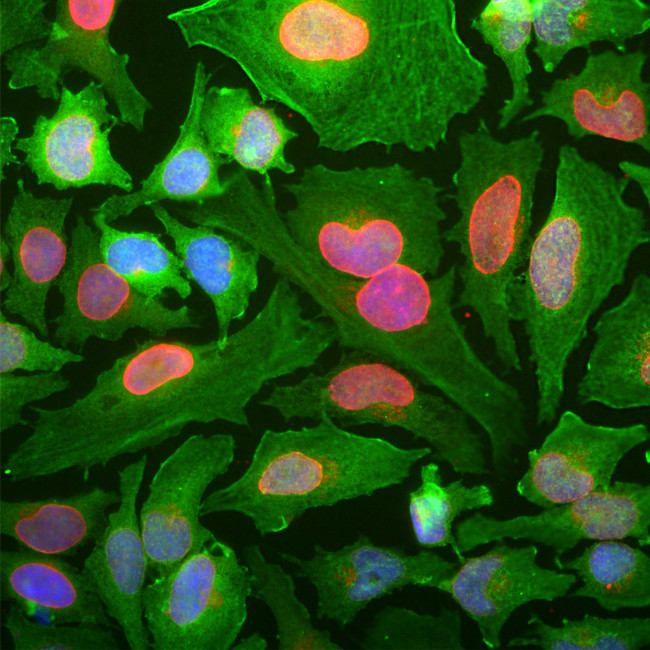 DJ-1 Antibody in Immunocytochemistry (ICC/IF)