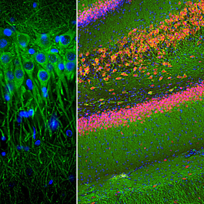 MAP2 Antibody in Immunohistochemistry (PFA fixed) (IHC (PFA))