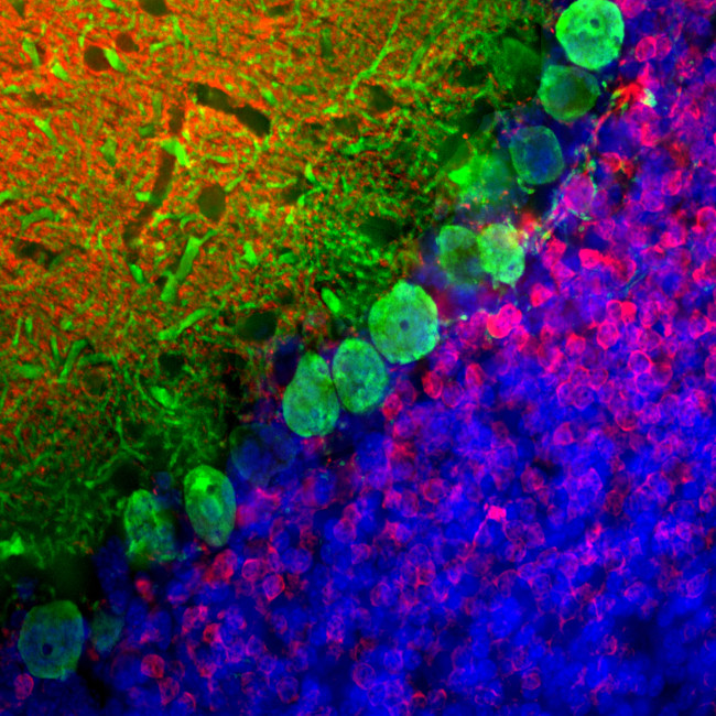 Calbindin D28K Antibody in Immunohistochemistry (PFA fixed) (IHC (PFA))