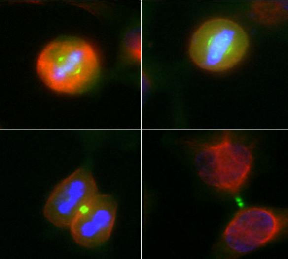 Aurora A/B Antibody in Immunocytochemistry (ICC/IF)