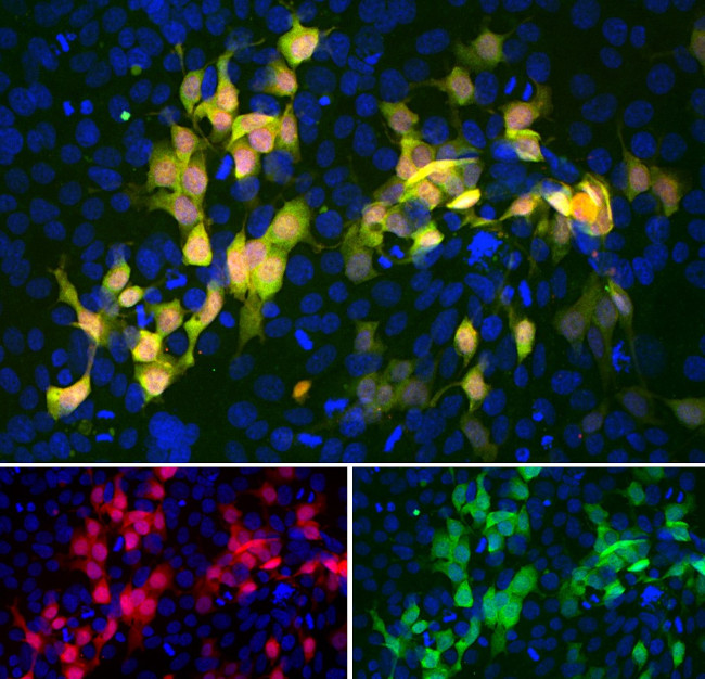 mCherry Antibody in Immunocytochemistry (ICC/IF)