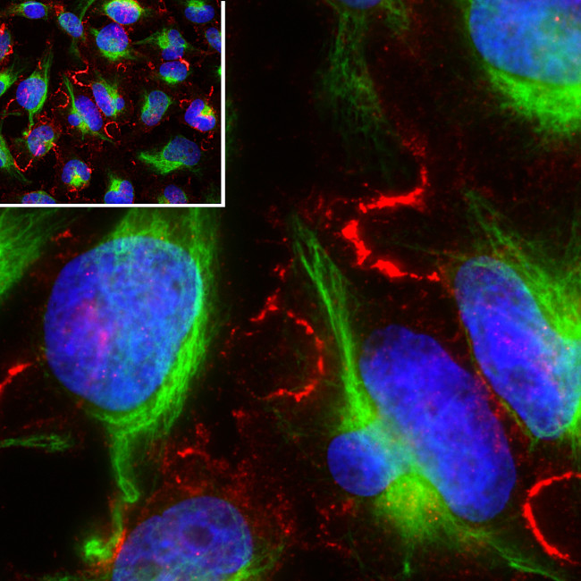 MARCKS Antibody in Immunocytochemistry (ICC/IF)