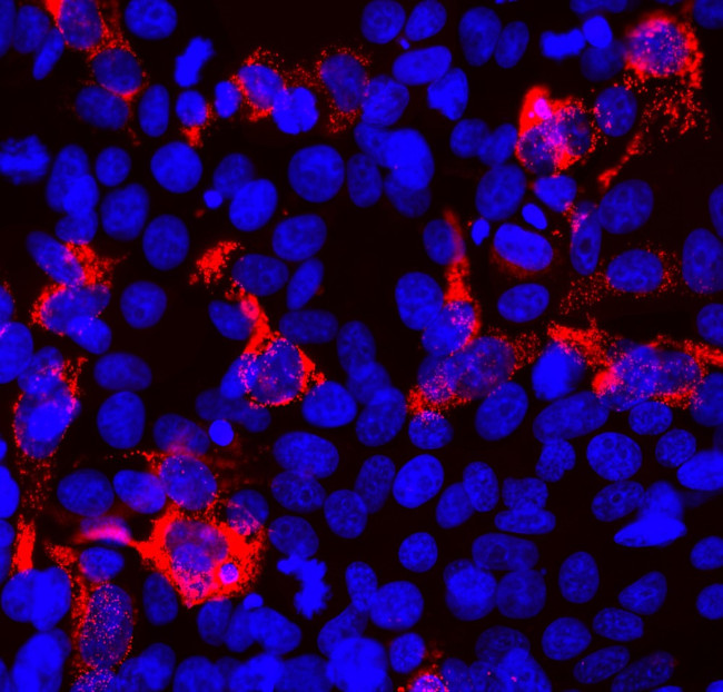 SARS-CoV-2 Spike Protein RBD Antibody in Immunocytochemistry (ICC/IF)