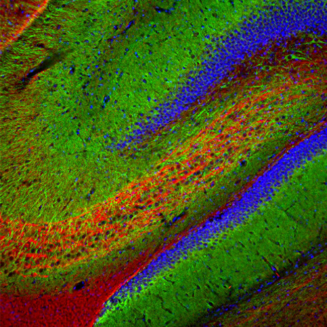 MAP2 Antibody in Immunohistochemistry (PFA fixed) (IHC (PFA))