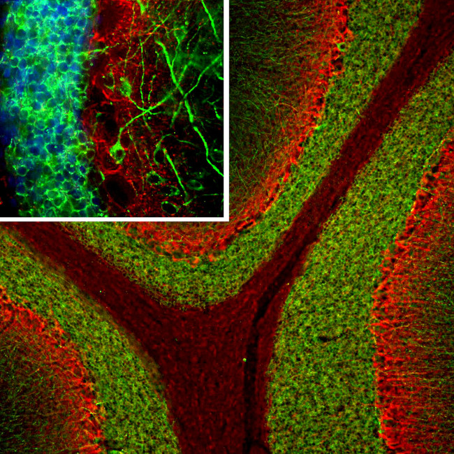 MAP2 Antibody in Immunohistochemistry (PFA fixed) (IHC (PFA))