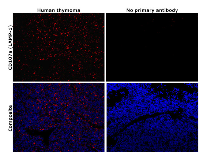 LAMP1 Antibody in Immunohistochemistry (Paraffin) (IHC (P))