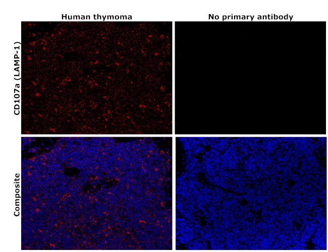 LAMP1 Antibody in Immunohistochemistry (Paraffin) (IHC (P))