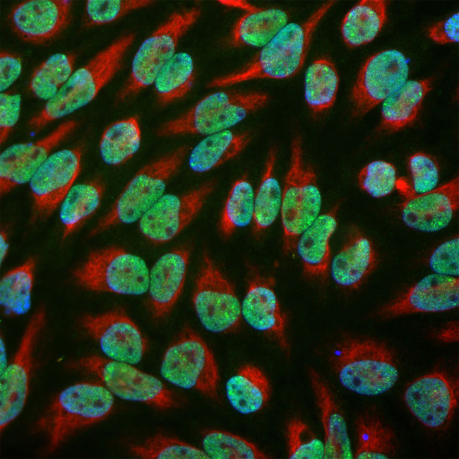 EWSR1 Antibody in Immunocytochemistry (ICC/IF)