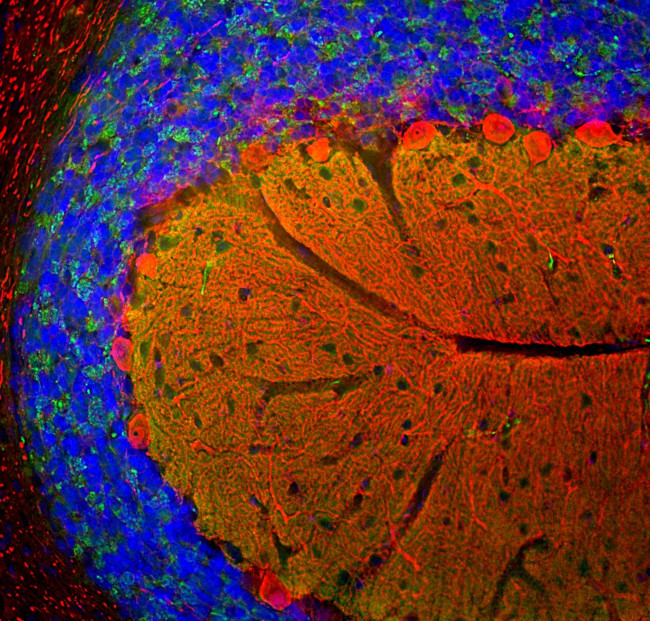 beta Synuclein Antibody in Immunohistochemistry (PFA fixed) (IHC (PFA))