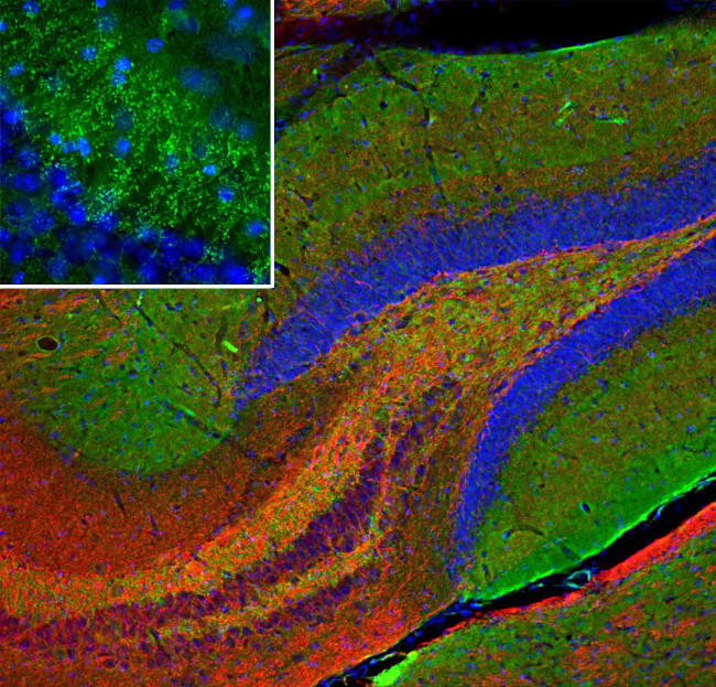 beta Synuclein Antibody in Immunohistochemistry (PFA fixed) (IHC (PFA))