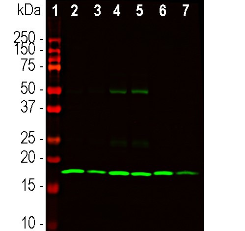 beta Synuclein Antibody in Western Blot (WB)