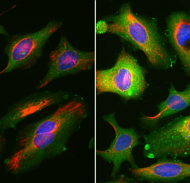 Annexin V Antibody in Immunocytochemistry (ICC/IF)