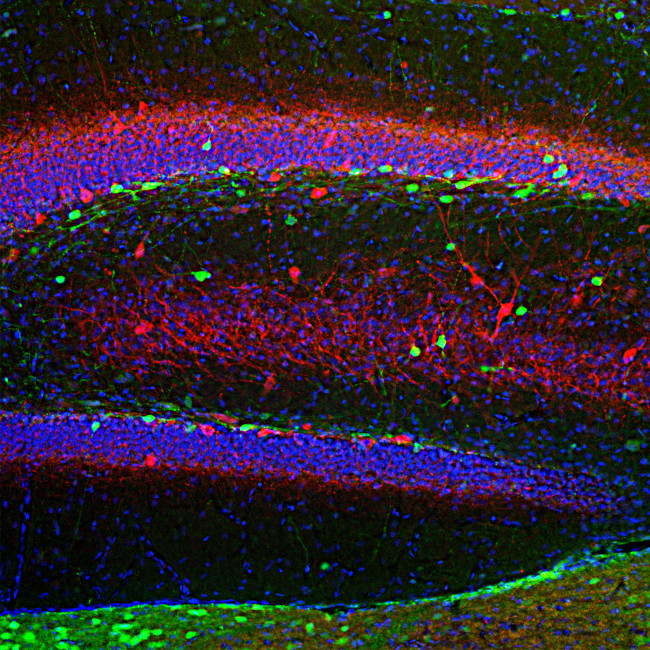 Calretinin Antibody in Immunohistochemistry (PFA fixed) (IHC (PFA))