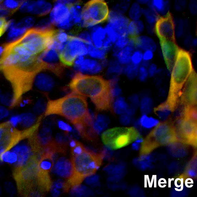 Cas9 Antibody in Immunocytochemistry (ICC/IF)