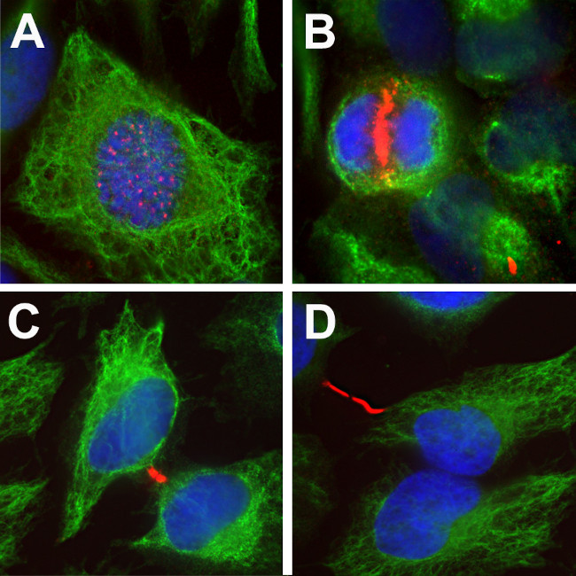 Aurora B Antibody in Immunocytochemistry (ICC/IF)