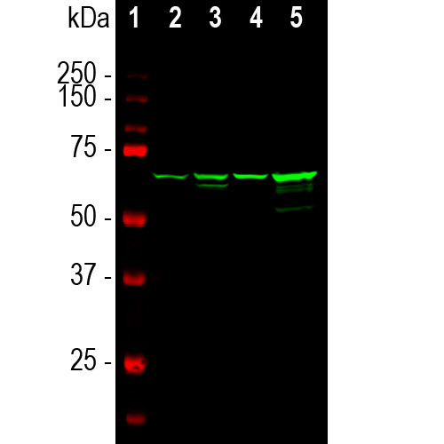 NEFL Antibody in Western Blot (WB)