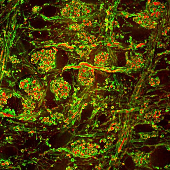 MBP Antibody in Immunohistochemistry (IHC)