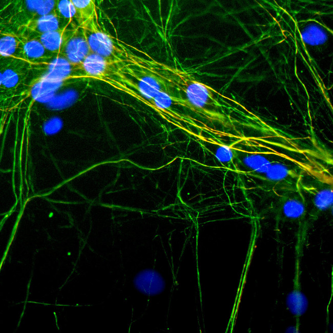 NF-H Antibody in Immunocytochemistry (ICC/IF)